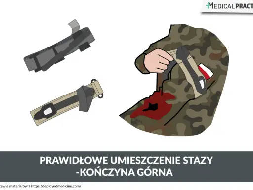Ilustracja pokazuje, co to jest staza taktyczna i jak ją prawidłowo założyć na kończynę górną żołnierza z raną.